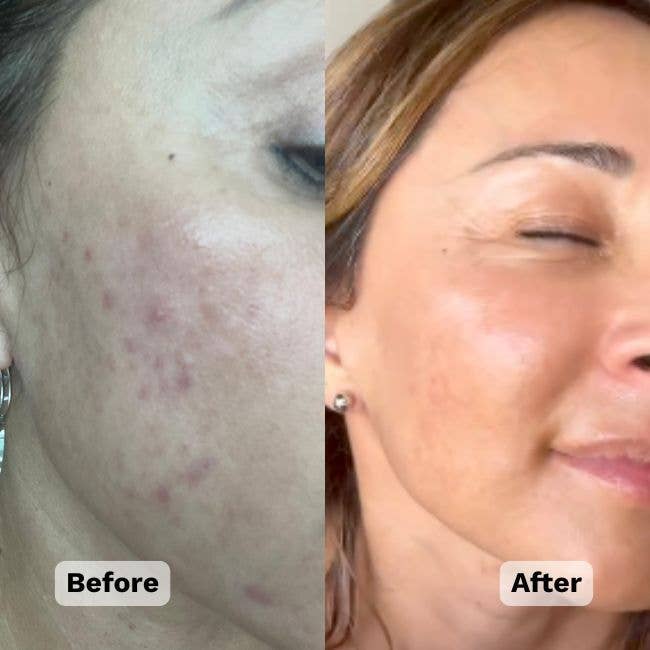 Organic Castor Oil Roll-on With Frankincense | Holistic Goddess